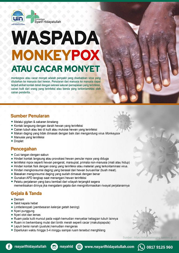 monkey pox